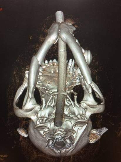 Eastcott referrals jaw fracture repair CT