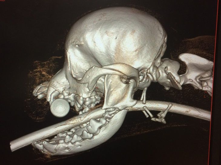 Eastcott referrals jaw fracture repair CT